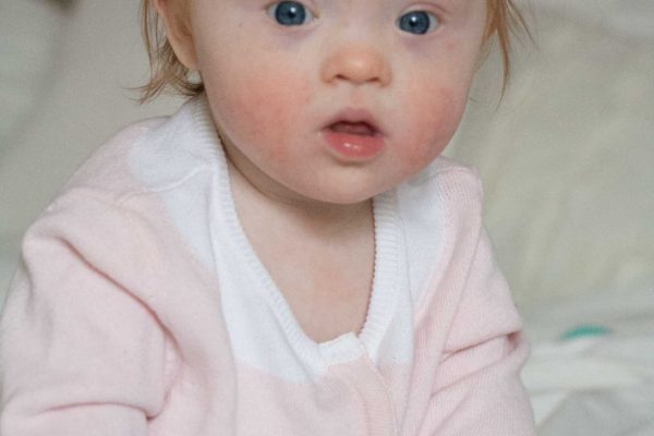 elsa 10 month baby update down syndrome development