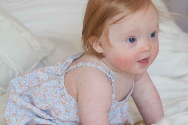 elsa 11 month update baby development down syndrome