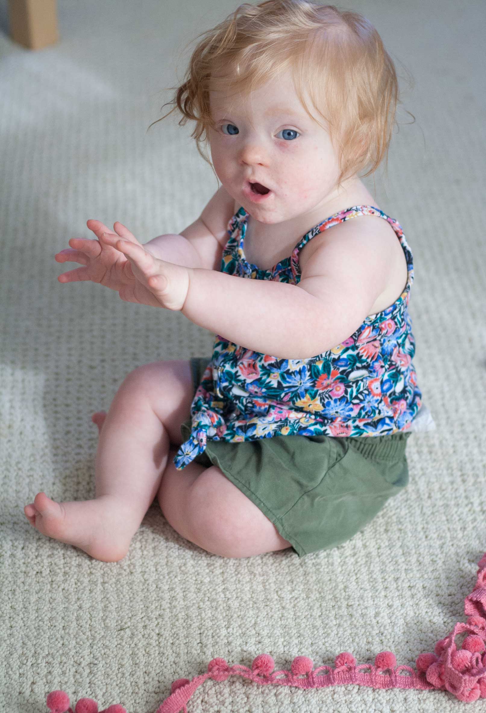 baby development 12 months down syndrome